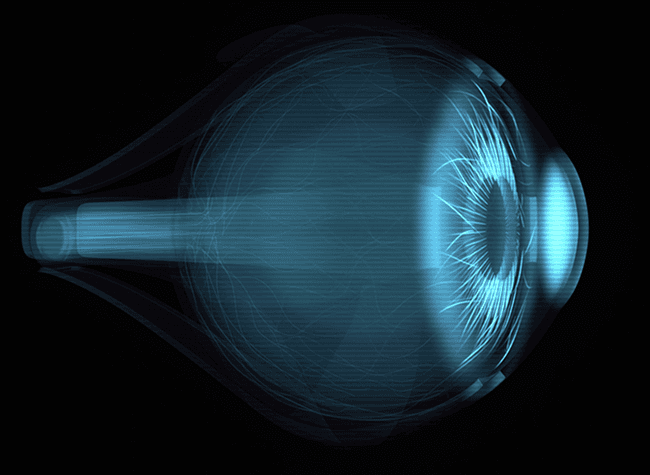 각막 구조의 변화로 인한 정밀 계산 필요