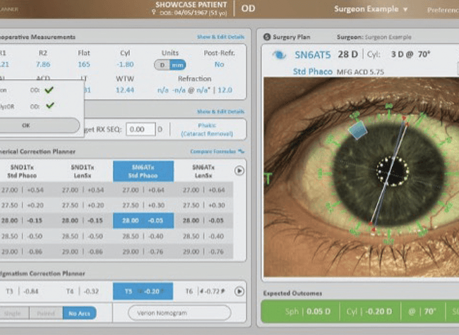 시력 예측의 복잡성