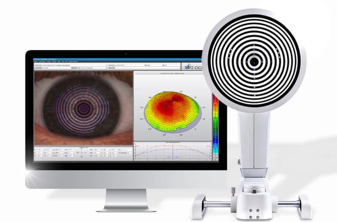 안구건조증 검사