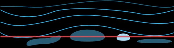 타 교정술 절개라인