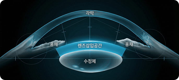 초정밀 안구 분석으로 개인별 변수까지 정확하게 파악