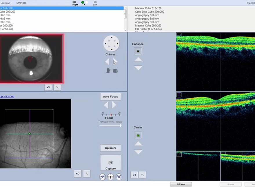 진행 상황을 지켜봐야 하는 경우